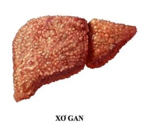 gan xơ