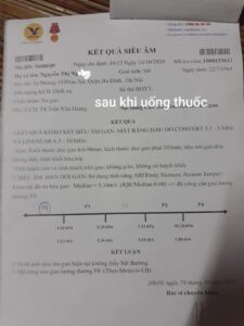 gan a súa - cách chữa xơ gan