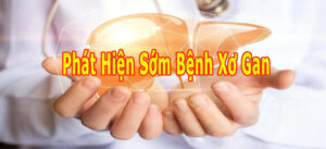 phát hiện sớm bệnh xơ gan