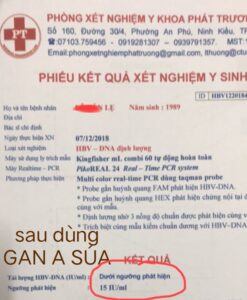 điều trị viêm gan b - gan a súa