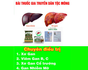 gan a súa điều trị bệnh gan