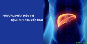 điều trị suy gan cấp