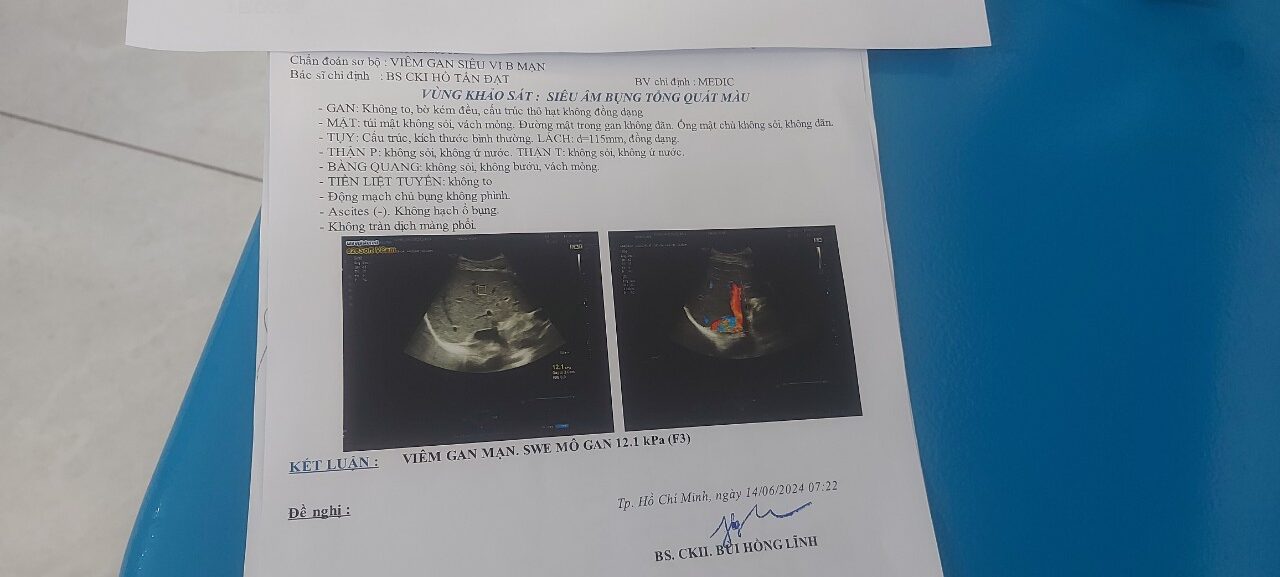 chỉ số xơ gan F3 của anh Hà