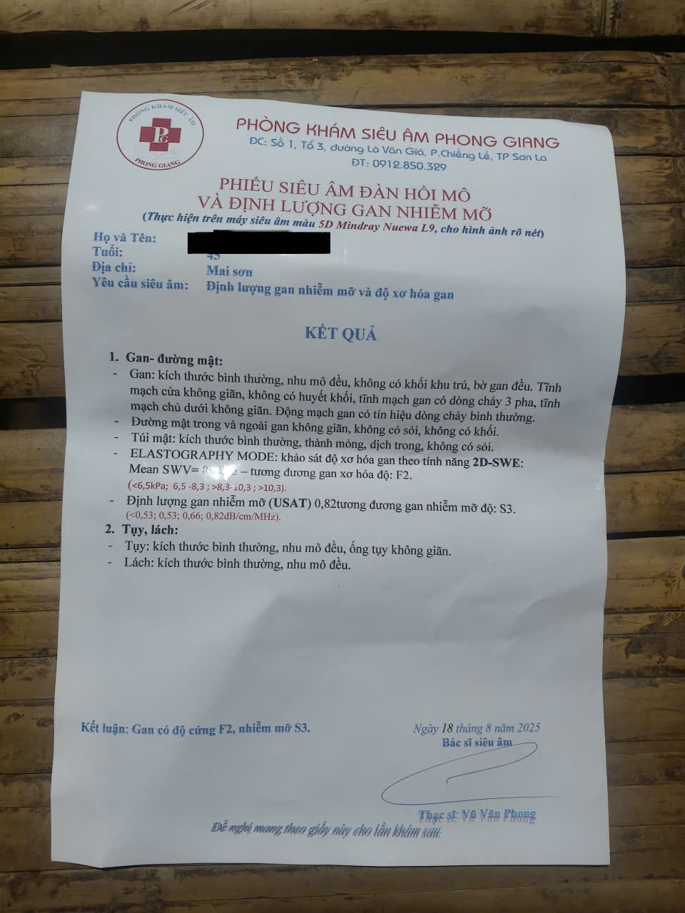 anh kiên bị xơ gan F2/ gan nhiễm mỡ s3